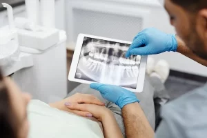 faqs-dental-implants-in-mumbai-offer-3